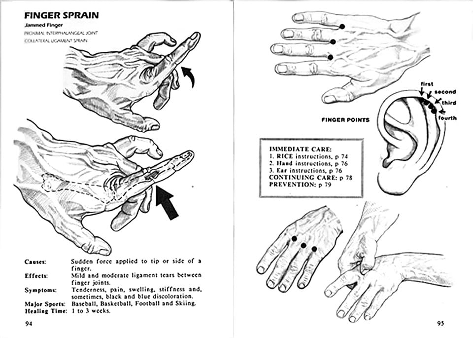 Finger sprains / strains can be helped with acupressure points